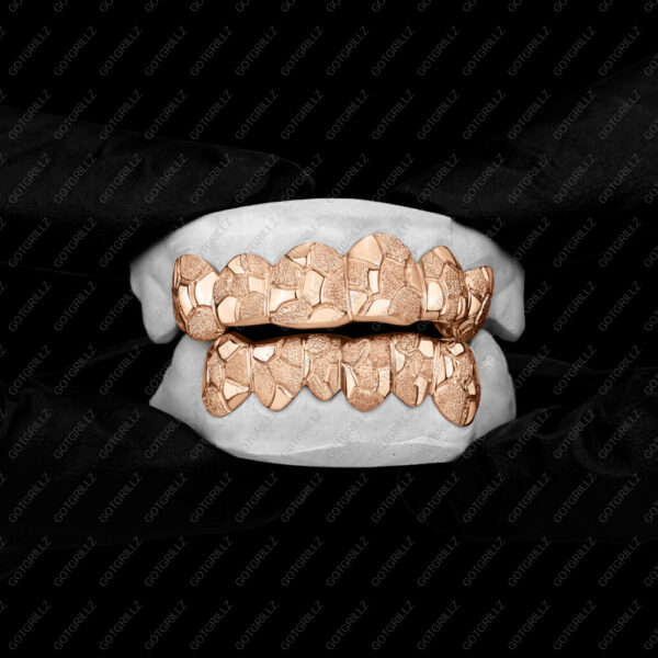 Rose Gold Nugget Grillz - GotGrillz