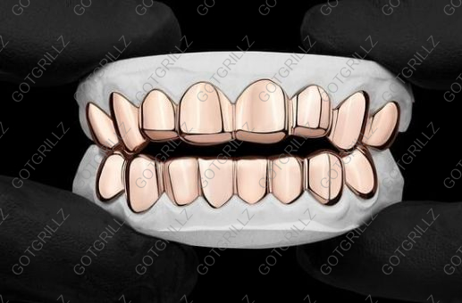 Custom Rose Gold Grillz - GotGrillz