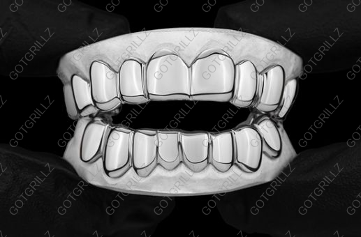 Custom White Gold Grillz - GotGrillz