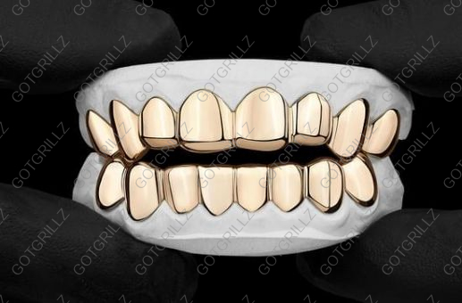 Custom Yellow Gold Grillz - GotGrillz