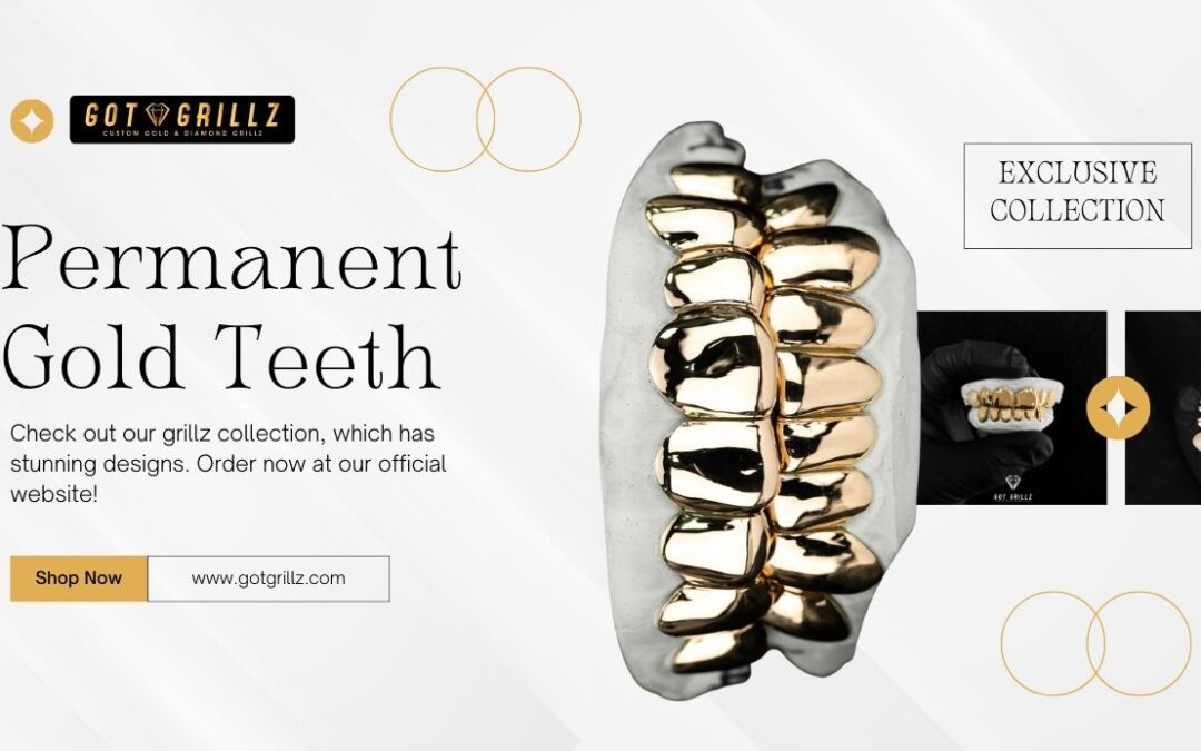 Where Can I Get Permanent Gold Teeth? Exploring Your Options