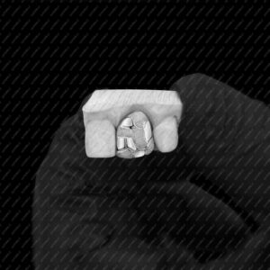 White Gold Nugget Single Tooth Grillz - GotGrillz