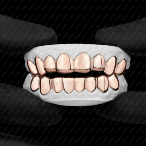 Rose Gold Polished Solid Classic Grillz - GotGrillz