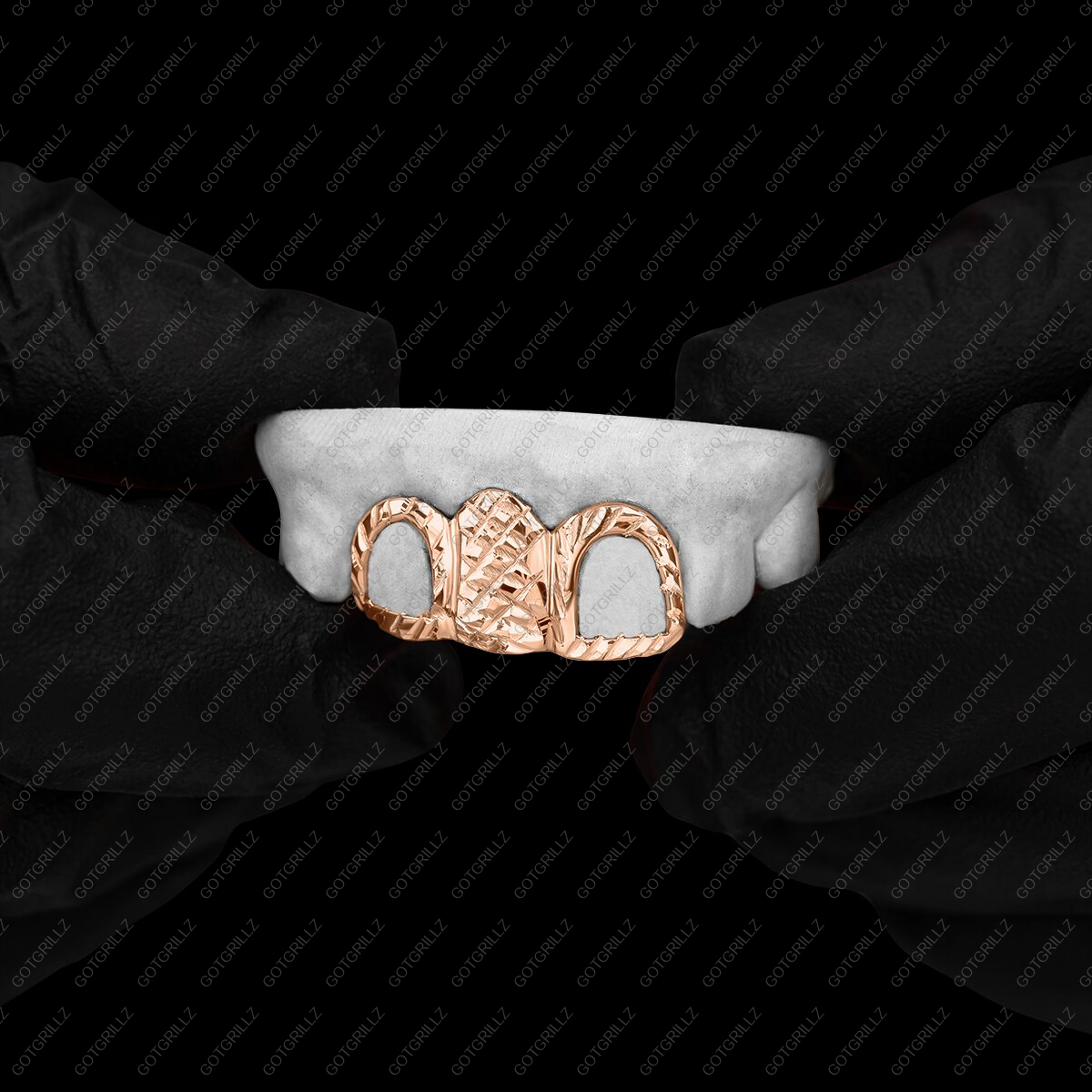 Custom 3 piece Rose Gold Diamond Cut Solid and Open Face Grillz - GotGrillz