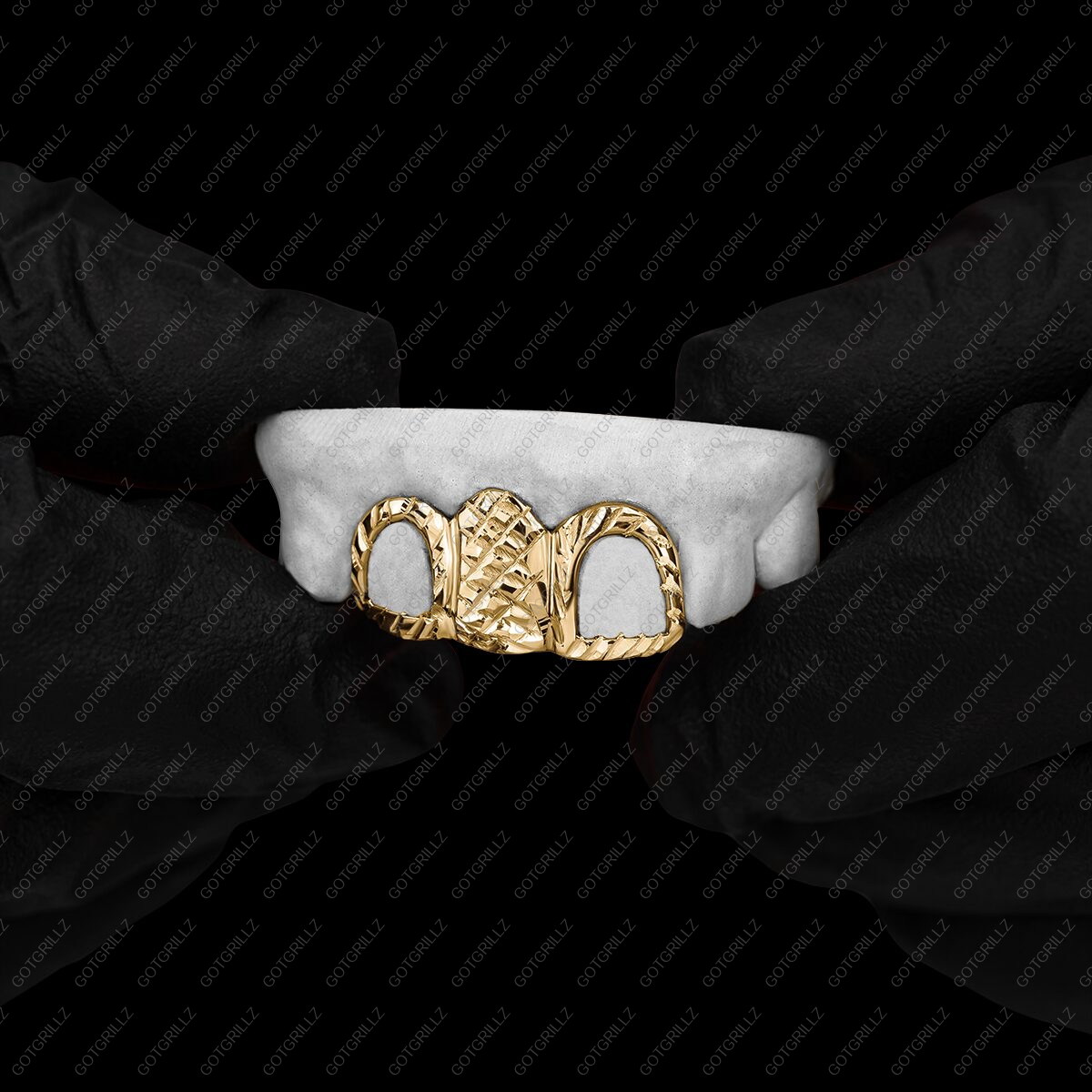 Custom 3 piece Yellow Gold Diamond Cut Solid and Open Face Grillz - GotGrillz