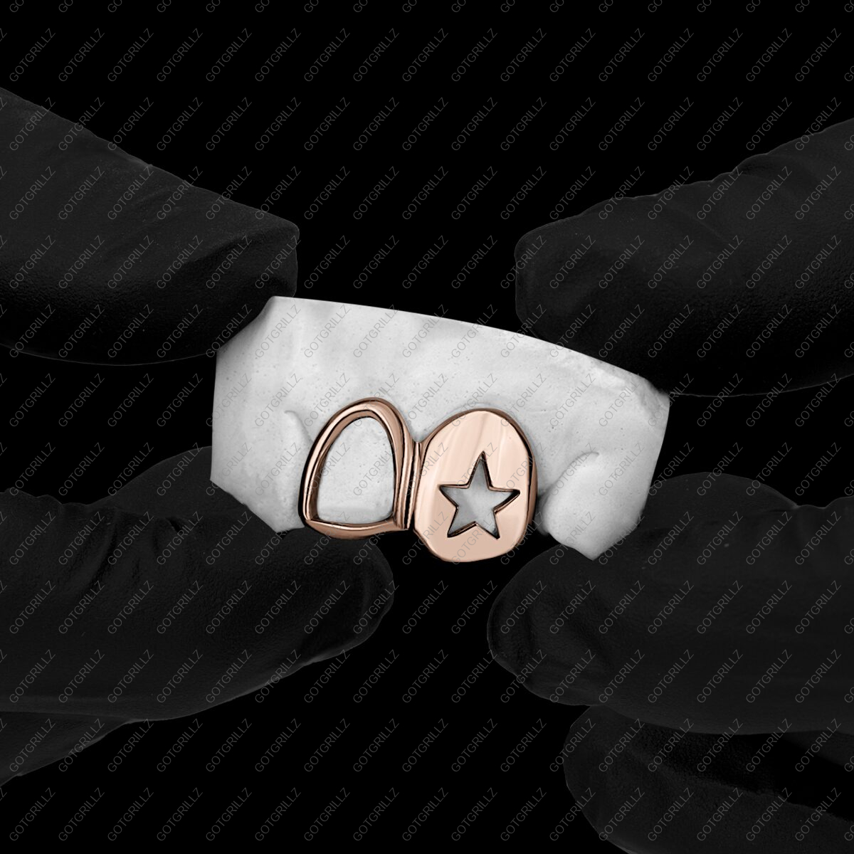 Rose Gold Star Cutout and Open Face Double Cap Grillz - GotGrillz