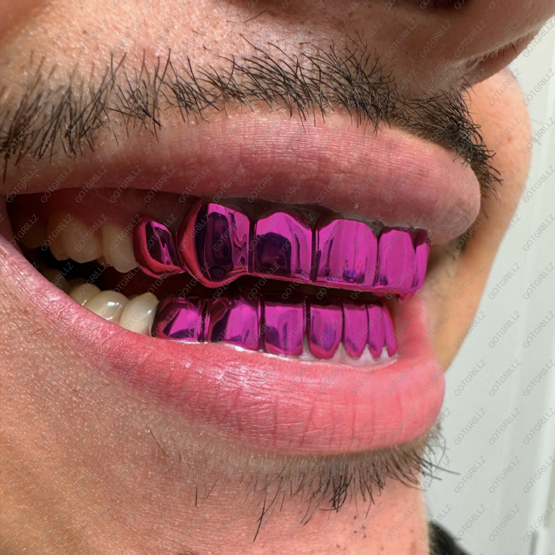 Pink Polished Solid Classic Grillz - GotGrillz