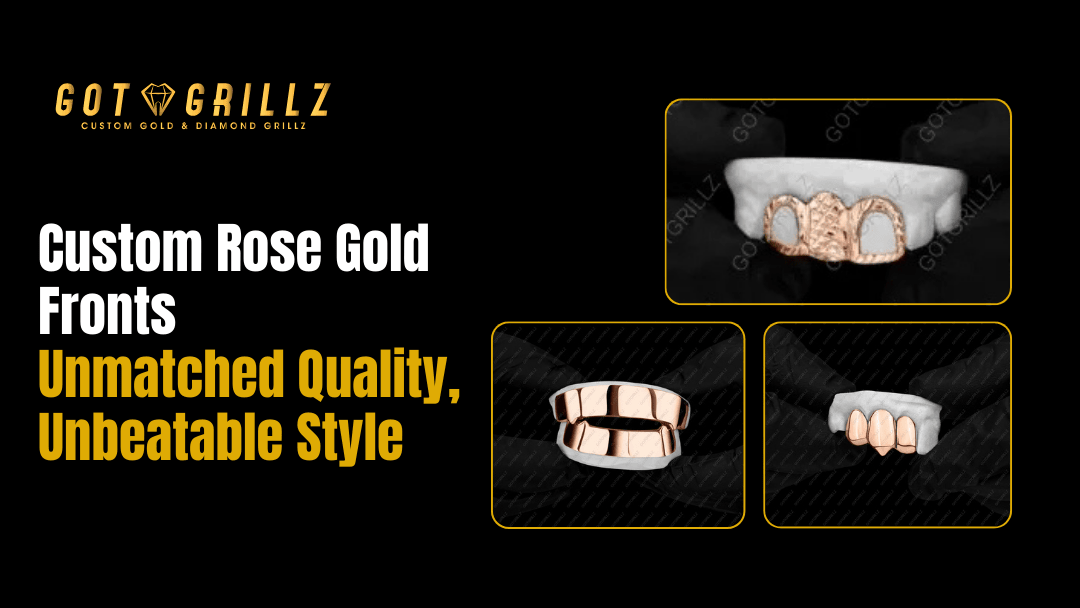 Custom Rose Gold Fronts Unmatched Quality, Unbeatable Style - GotGrillz