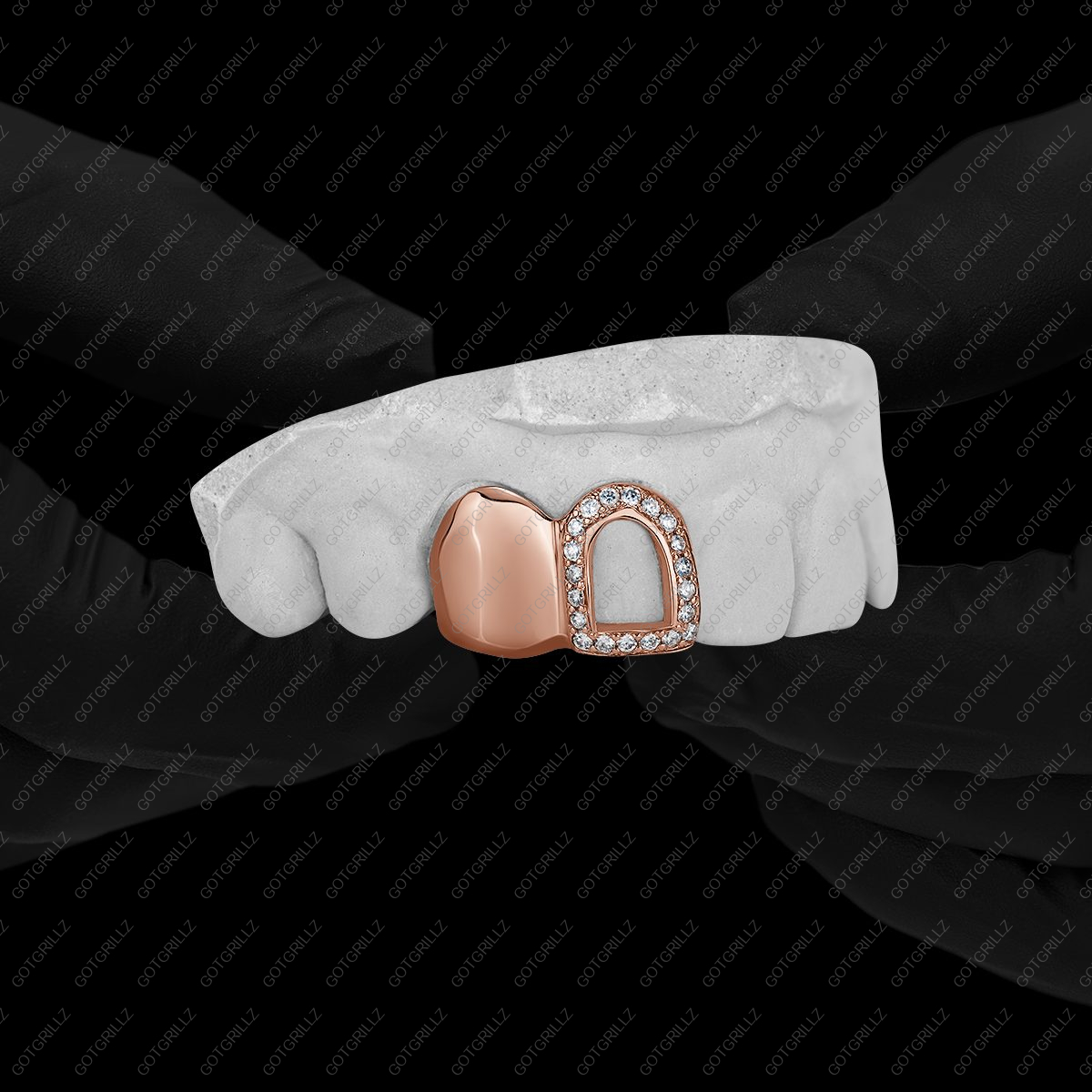 Rose Gold Solid K9 and Diamond Open Face Double Cap Grillz - GotGrillz