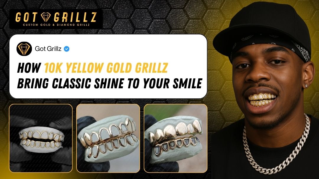How 10k Yellow Gold Grillz Bring Classic Shine to Your Smile - Got Grillz