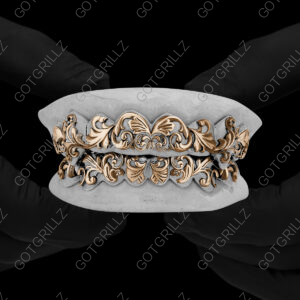 Yellow and White Gold Two Tone Polished Victorian Floral Pattern Grillz