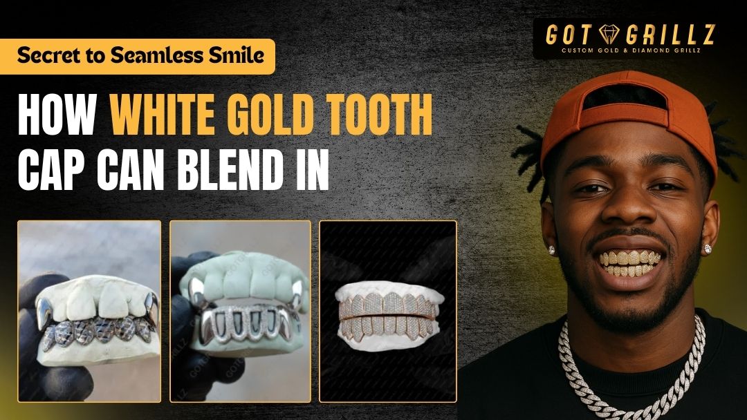 Secret to Seamless Smile: How White Gold Tooth Cap Can Blend In