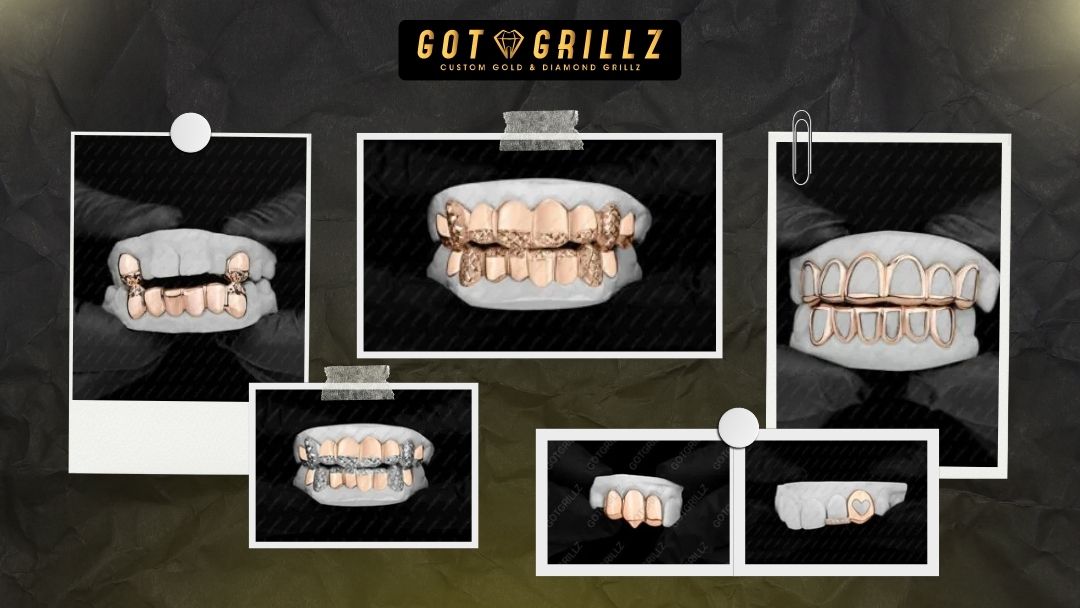 Rose Gold Diamond Grillz - GotGrillz