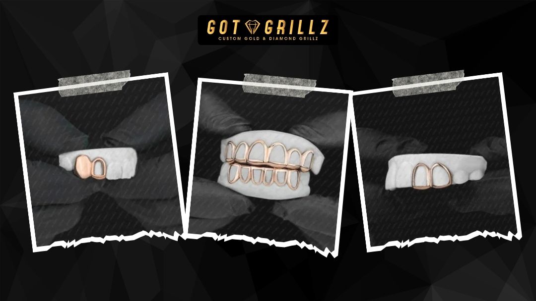 How to Style Diamond Open Face Grillz for a Bold Look - GotGrillz
