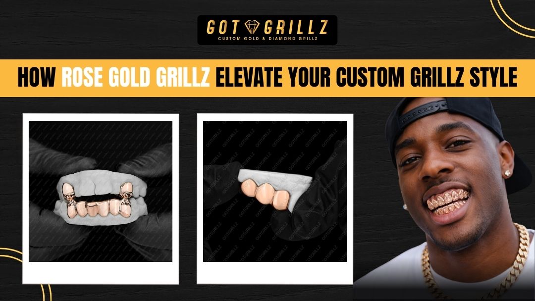 How Rose Gold Grillz Elevate Your Custom Grillz Style - GotGrillz