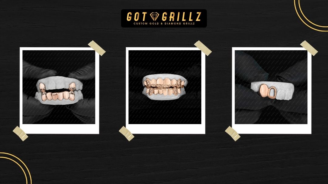 How Rose Gold Grillz Elevate Your Custom Grillz Style - GotGrillz