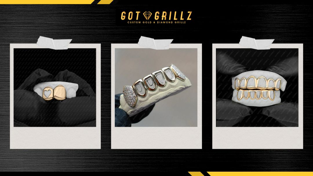 Open Face Grillz - GotGrillz