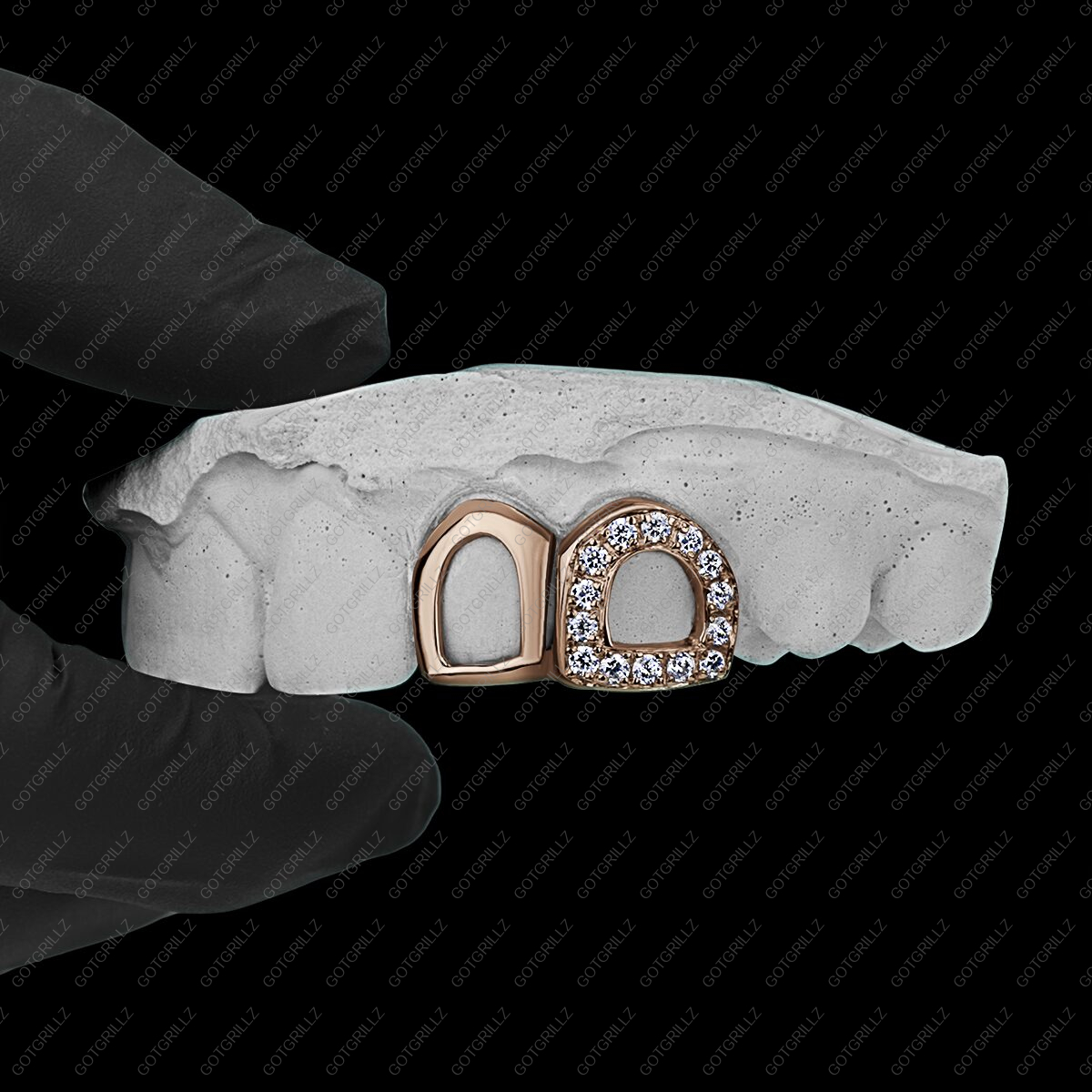 Gold Diamond Open Face and Solid Open Face Double Cap Grillz