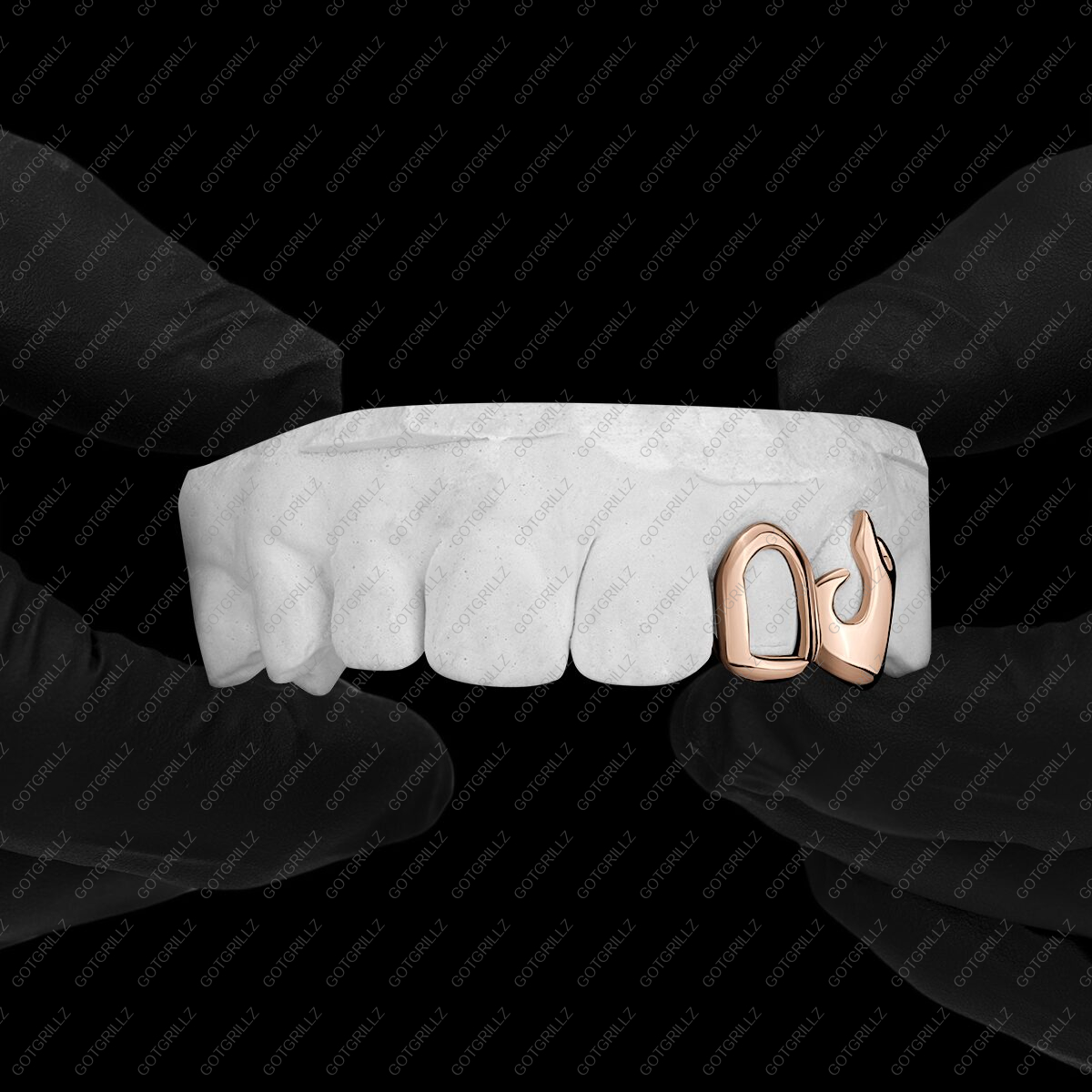 Gold Flame K9 and Open Face Double Cap Grillz