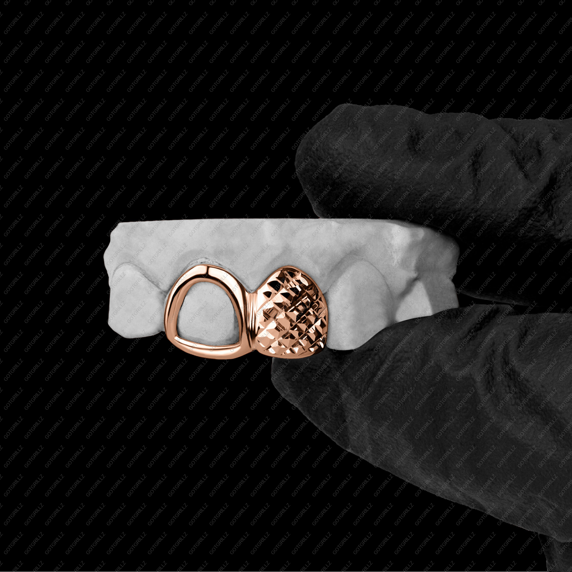 Gold Open Face and Diamond Cut Double Cap Grillz