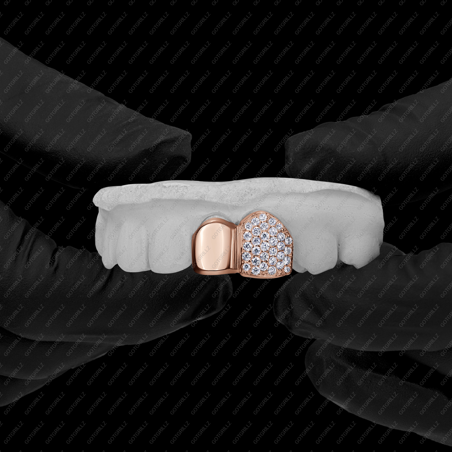 Gold Solid and Honeycomb Diamond Double Cap Grillz