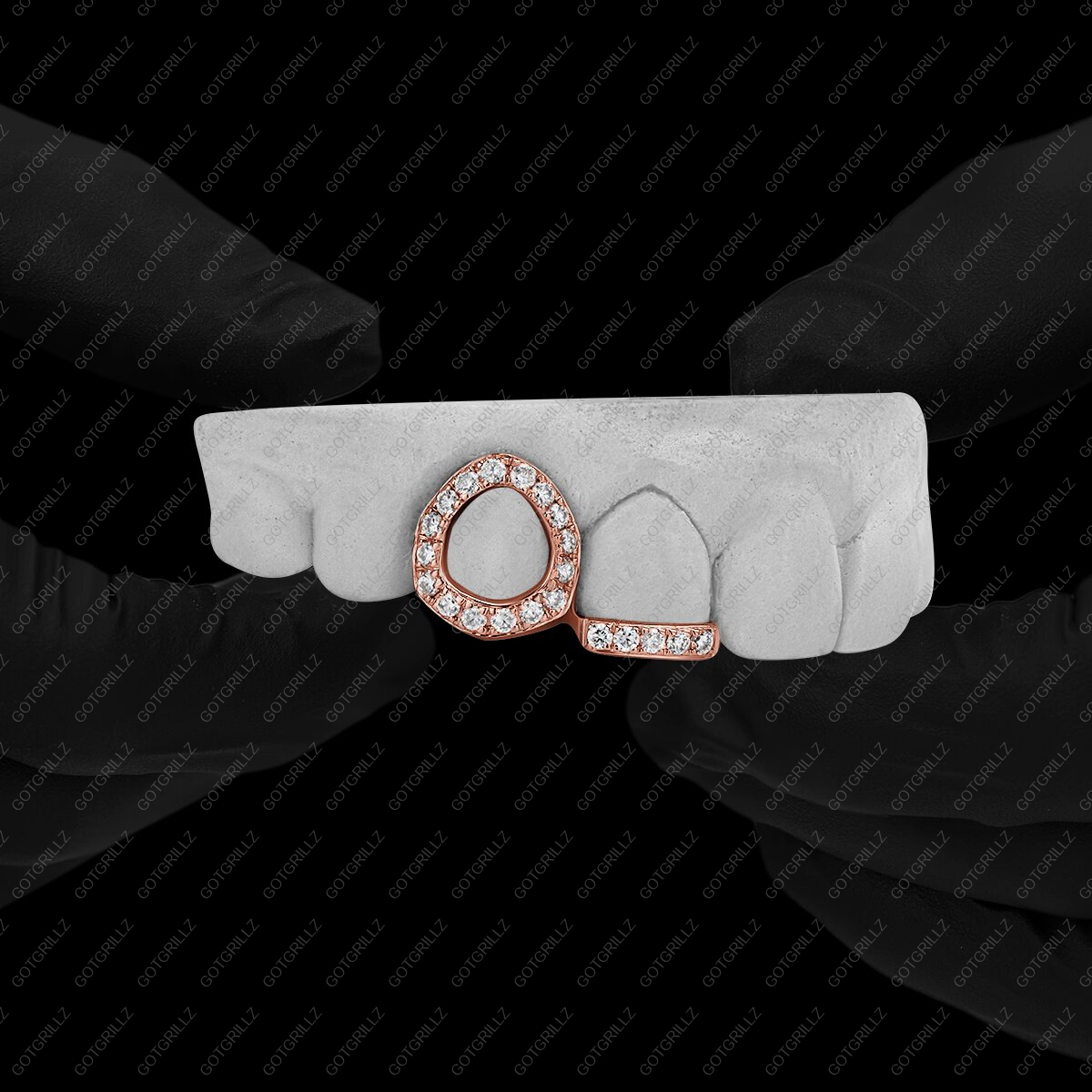 Gold Diamond Open Face and Bottom Bar Double Cap Grillz