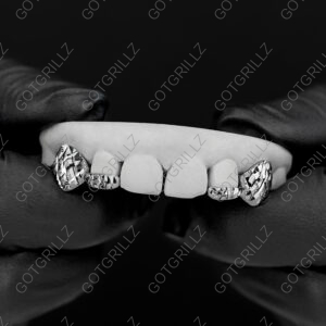 White Gold Diamond Cut K9 and Bottom Bar Grillz