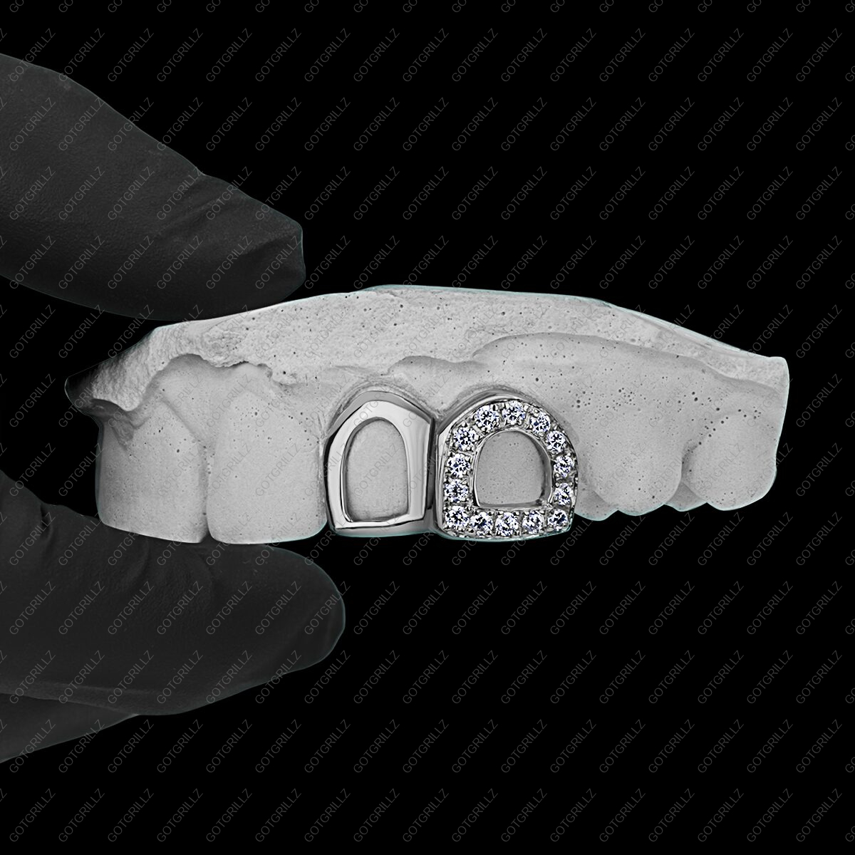 Gold Diamond Open Face and Solid Open Face Double Cap Grillz