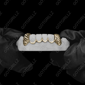 Gold Diamond Cut K9s with Outline Grillz