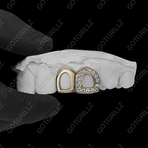 Gold Diamond Open Face and Solid Open Face Double Cap Grillz