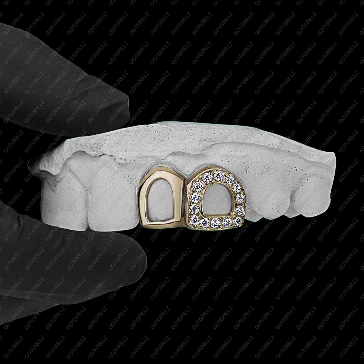 Gold Diamond Open Face and Solid Open Face Double Cap Grillz