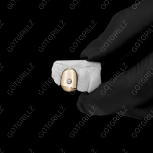 Gold Solitaire Diamond Cap Grillz