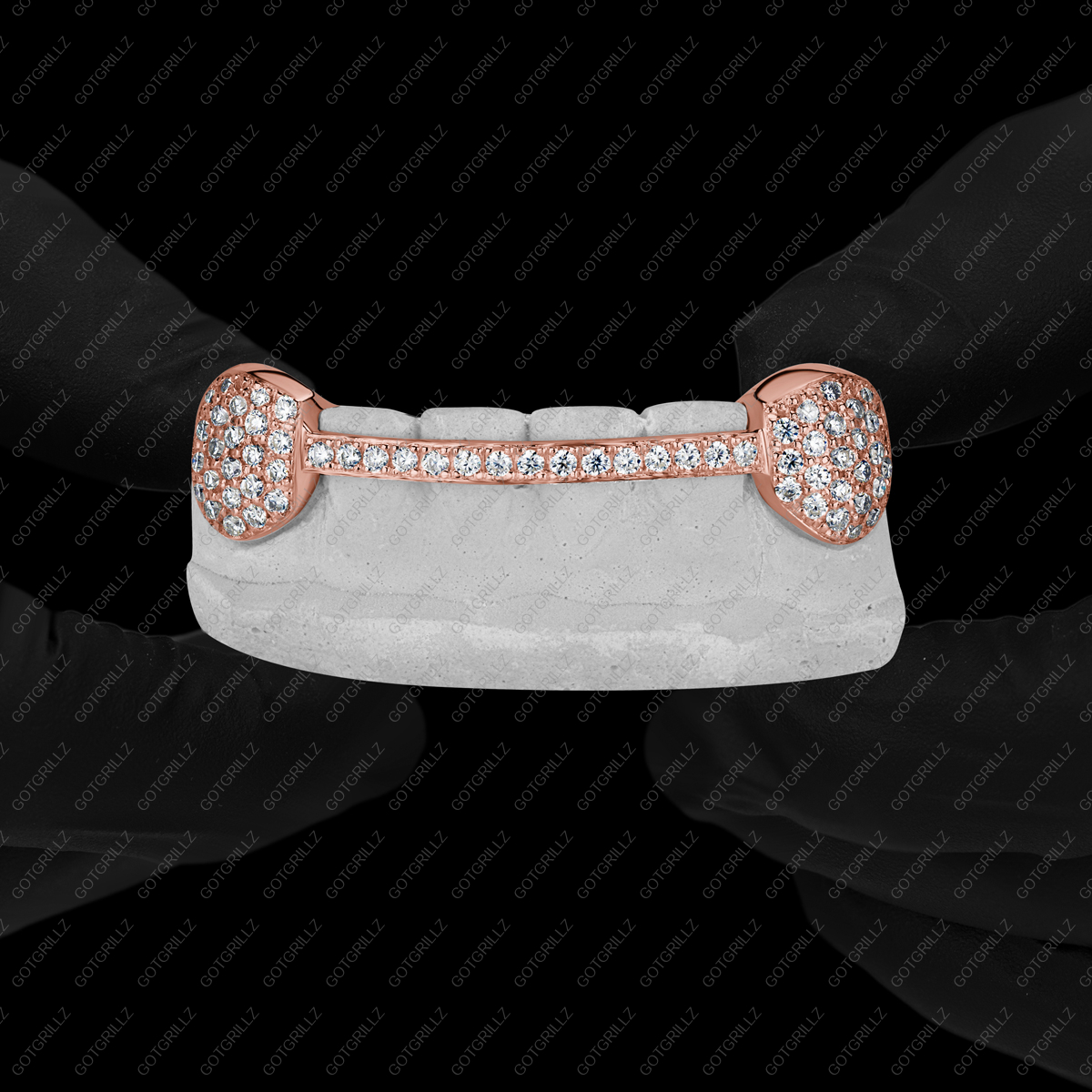 Gold Diamond K9s with Diamond Middle Bar Grillz