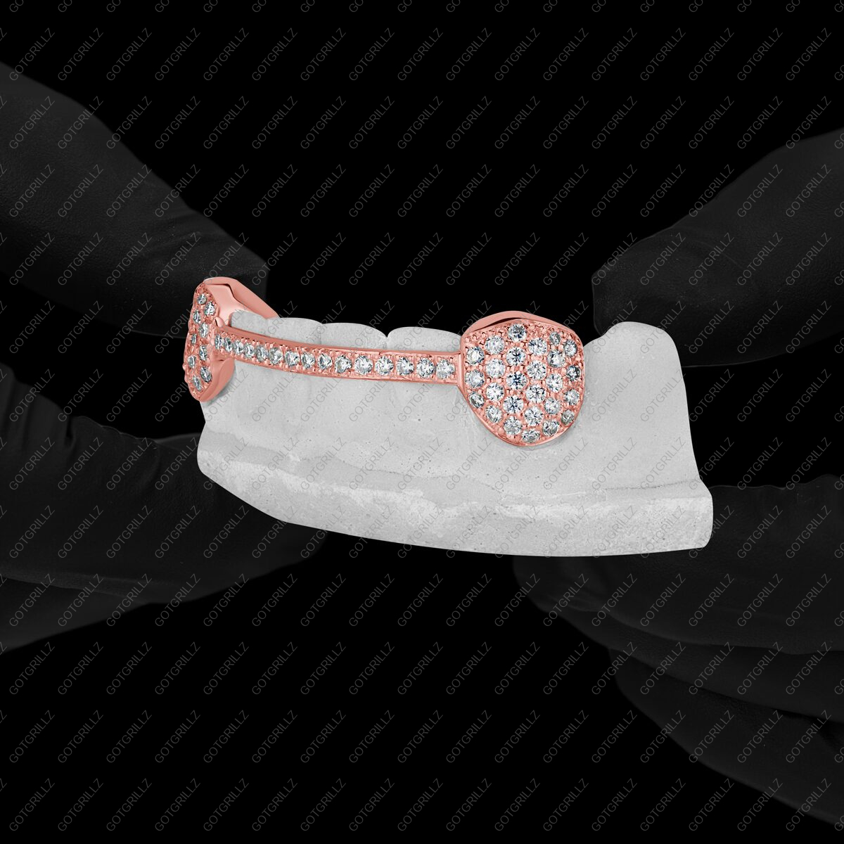 Gold Diamond K9s with Diamond Middle Bar Grillz