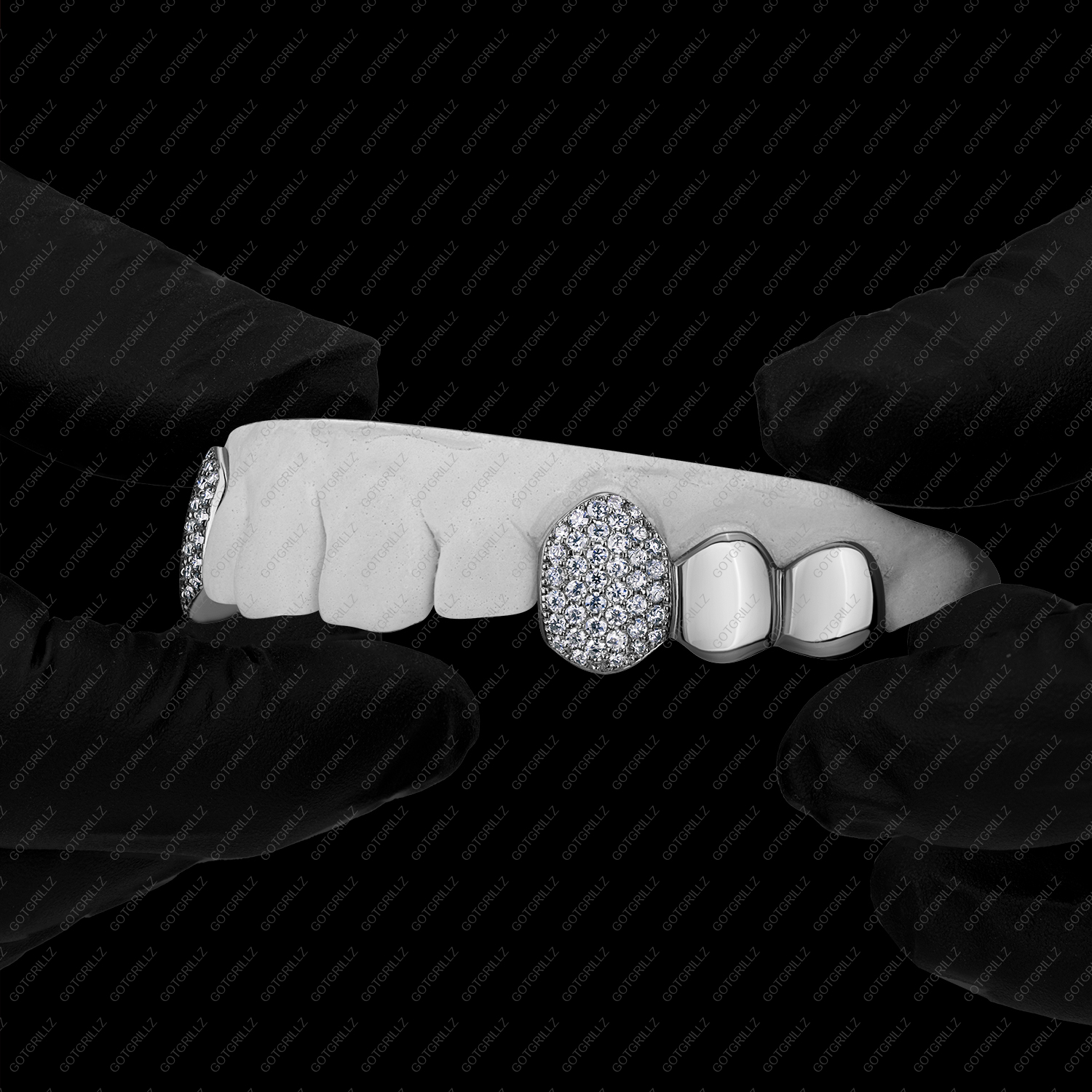 Gold Diamond K9 and Solid Gold Molars Grillz