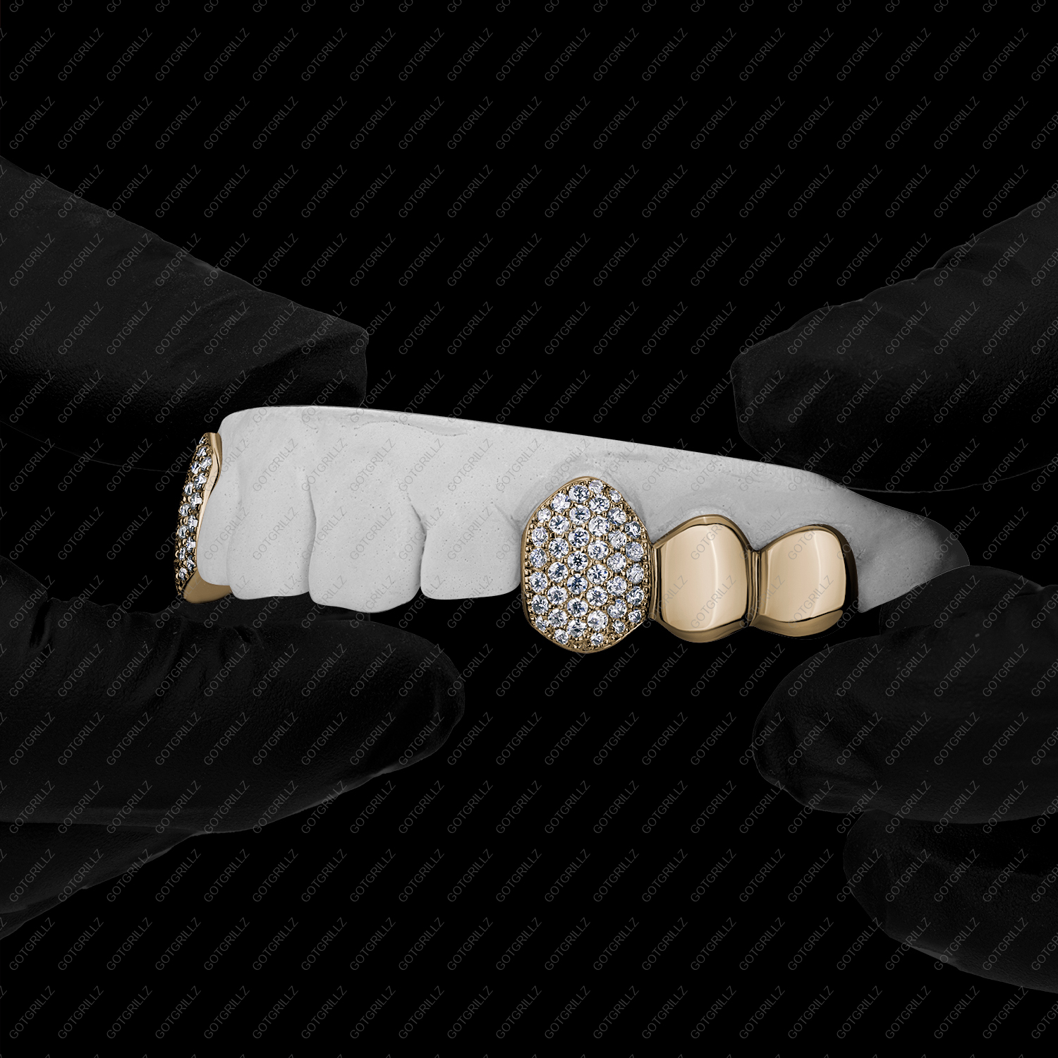 Gold Diamond K9 and Solid Gold Molars Grillz