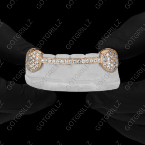 Gold Diamond K9s with Diamond Middle Bar Grillz - GotGrillz