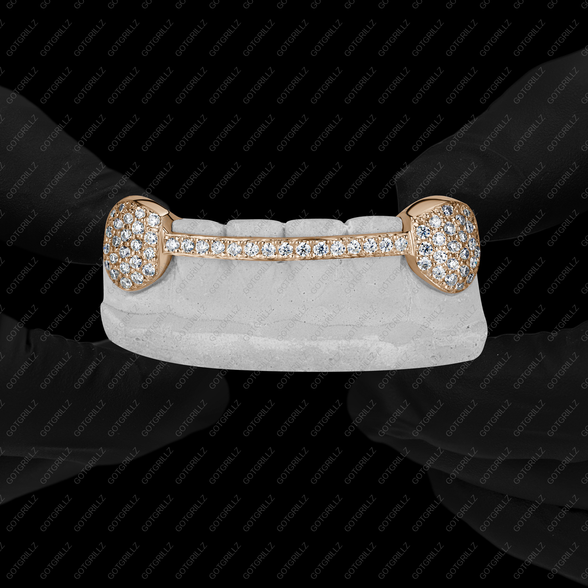 Gold Diamond K9s with Diamond Middle Bar Grillz