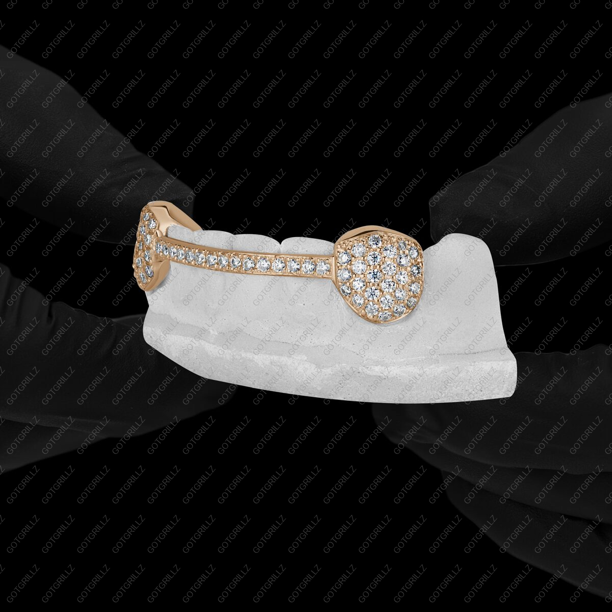Gold Diamond K9s with Diamond Middle Bar Grillz