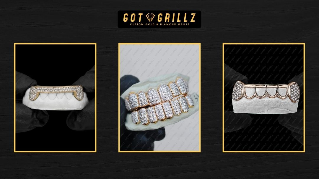 Diamond Grillz - GotGrillz